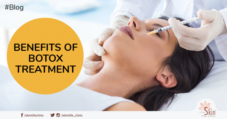 botox treatment benefits