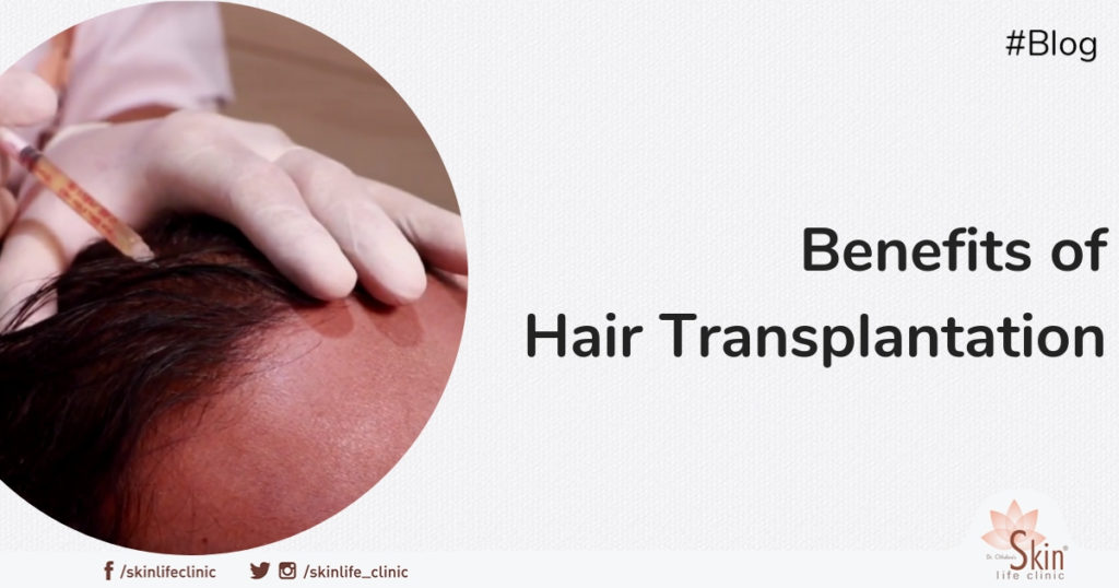 Hair Transplant Procedure