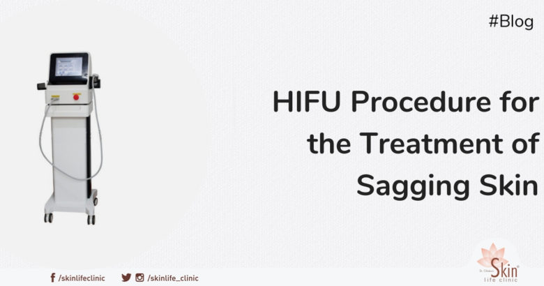 HIFU Procedure for the Treatment of Sagging Skin