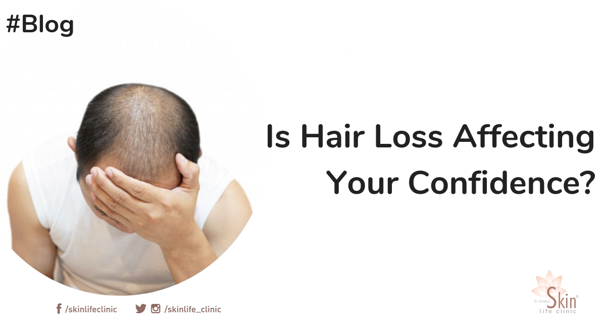 Is Hair Loss Affecting Your Confidence?