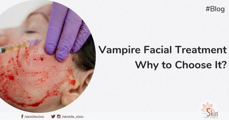 Vampire Facial Treatment - Why to Choose It