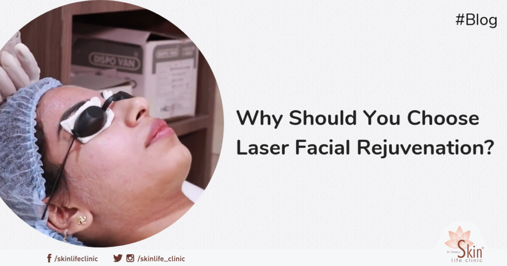 Why Should You Choose Laser Facial Rejuvenation