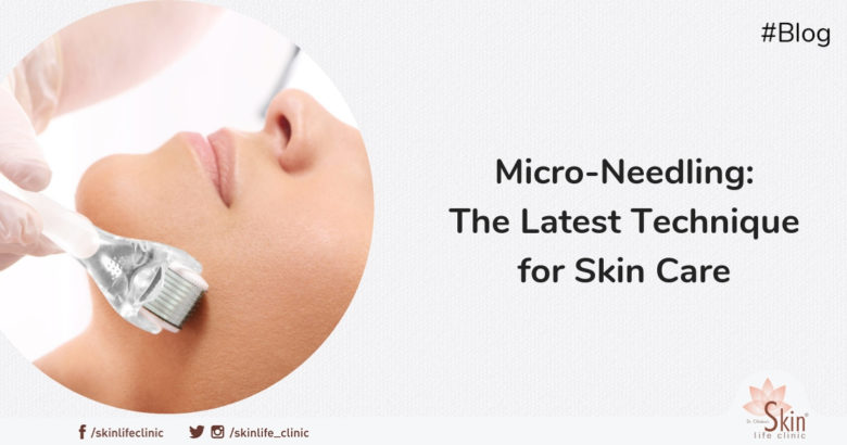 MicroNeedling - The Latest Technique for Skin Care