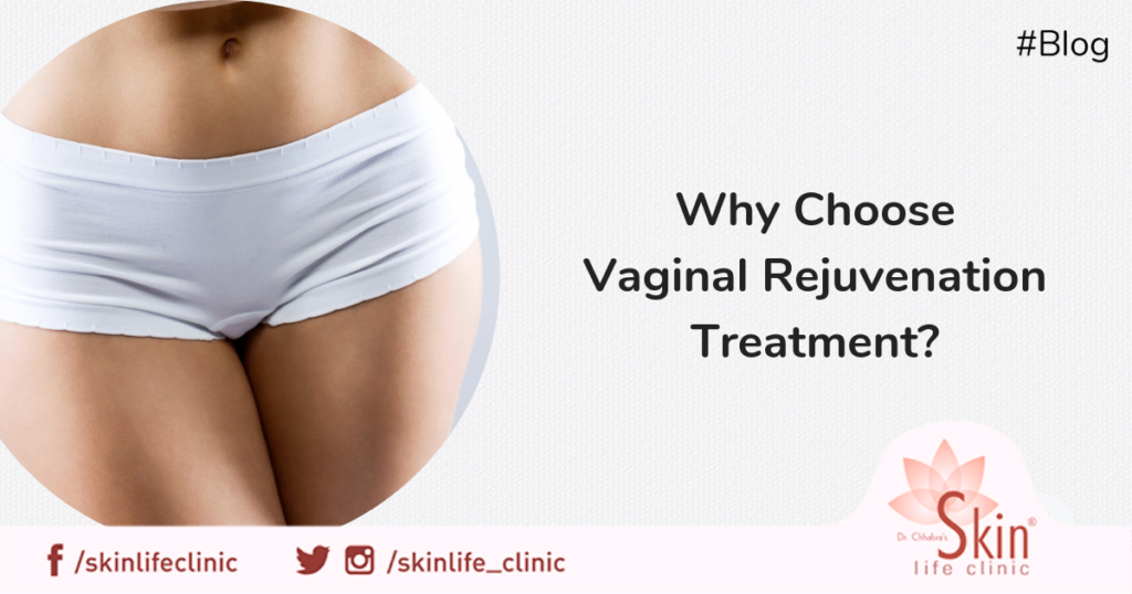 Why Choose Vaginal Rejuvenation Treatment