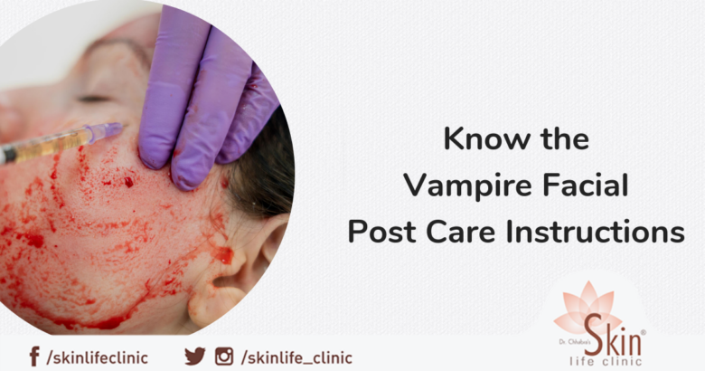 Know the Vampire Facial Post Care Instructions