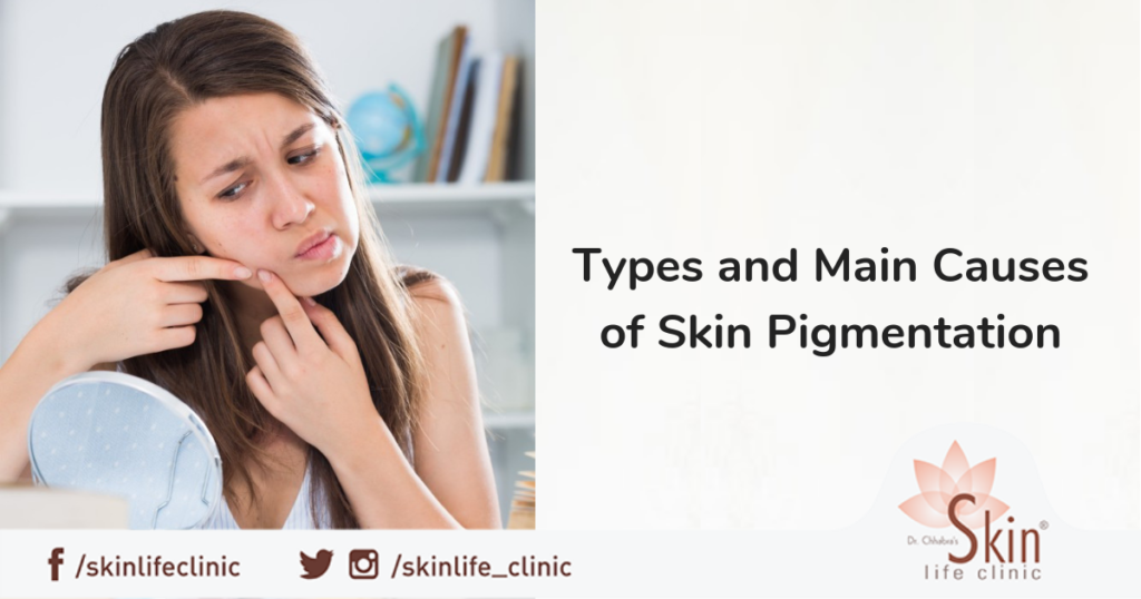 Types and Main Causes of Skin Pigmentation