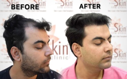 WhatsApp Image 2025-06-12 at 2.06.01 PM